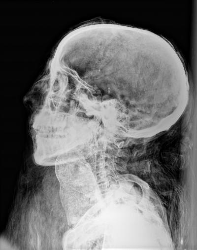 Mummy Image (Head 1)