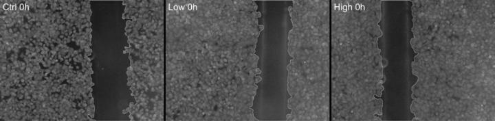 Skin Cells Crawl Together