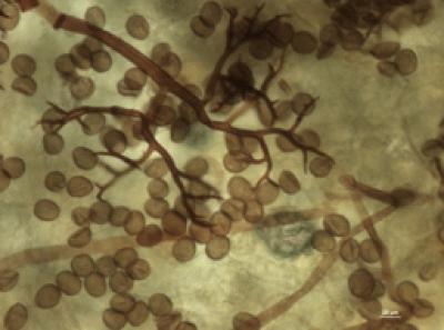Basil Leaf Infected with <i>Peronospora belbahrii</i>