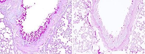 Mucus Production in Lung after Inhaling Allergen with or without Functional Il-33 Sensor
