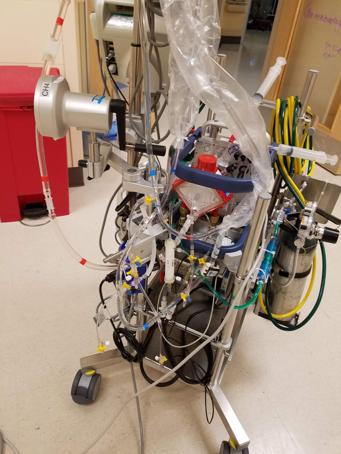 ECMO