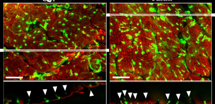 Loss of microbiota alters the profile of cells that protect the intestinal wall