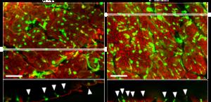 Loss of microbiota alters the profile of cells that protect the intestinal wall