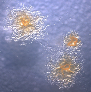 Flavobacterium columnare