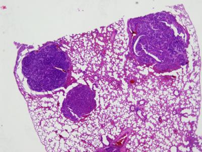 Section of Lung Tissue