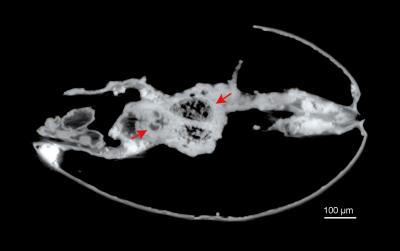 Tomography