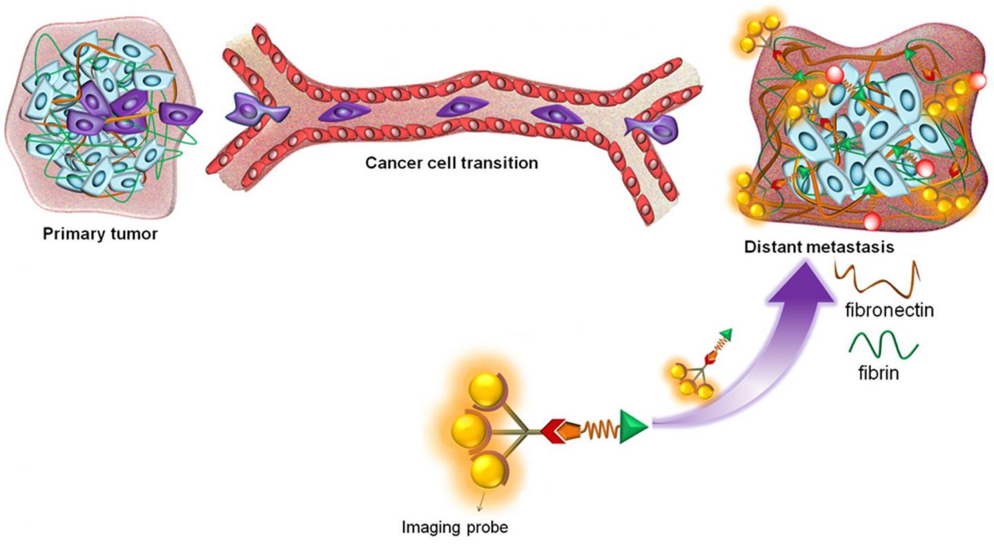 MRI Detects Early Breast Cancer Metastases in Mice