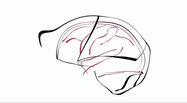 Visualization of Differences between Mean Human and Chimpanzee Brains and Braincases