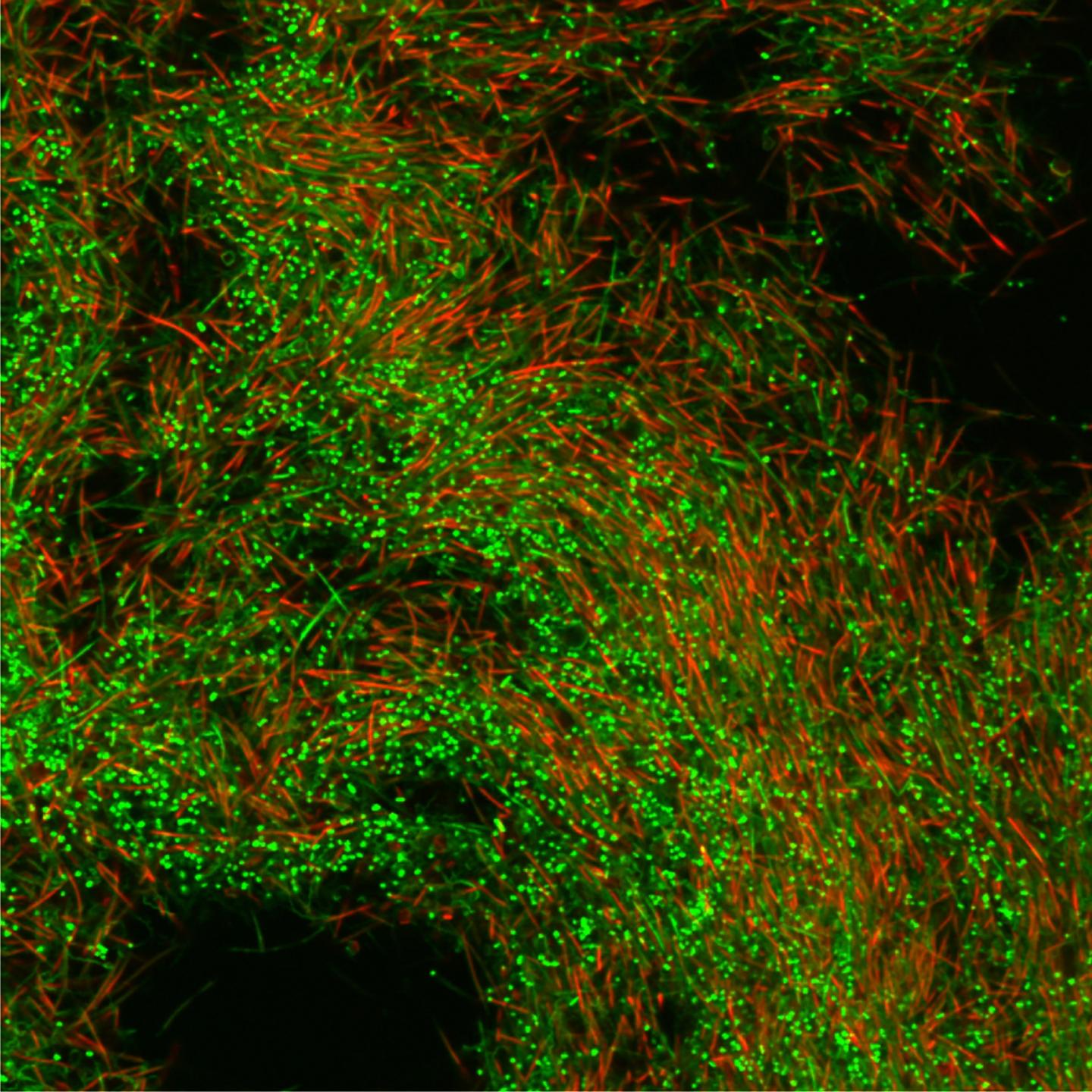 Microscopic Image of Bacteria in Dental Plaque