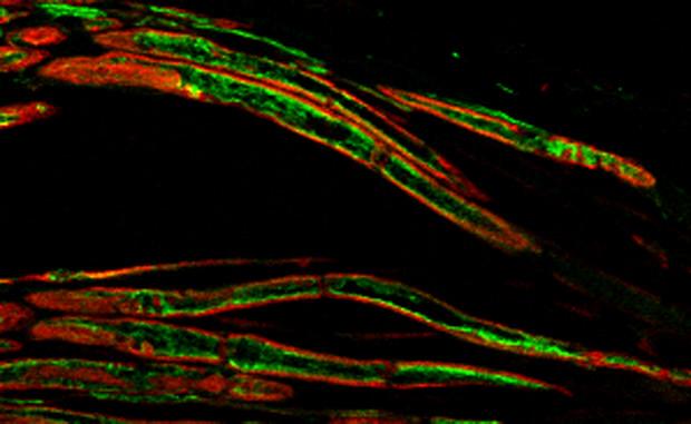 Acetylated Tubulin in Sensory Neuron Axons