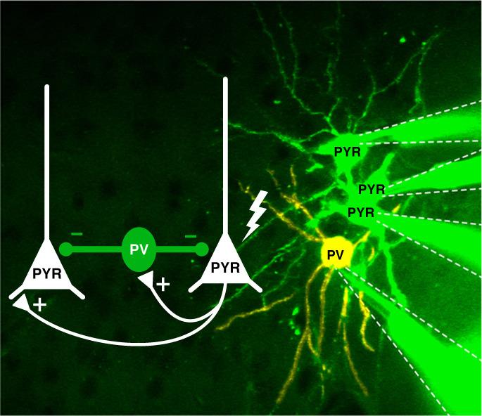 Pyramidal Cells