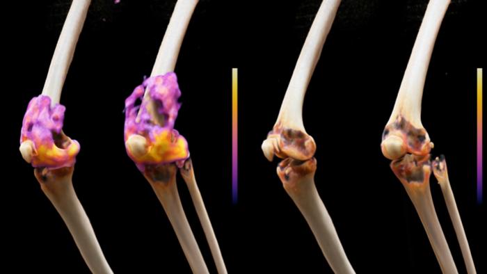 Knee joints of a study participant before and after treatment