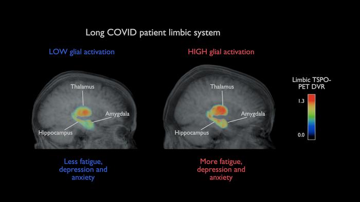 TSPO-PET images of the brain