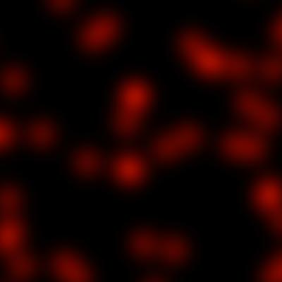 Detailed Fermi LAT View of GRB 130427A