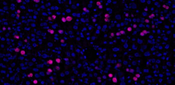 Use of supplement before surgery improves liver regeneration