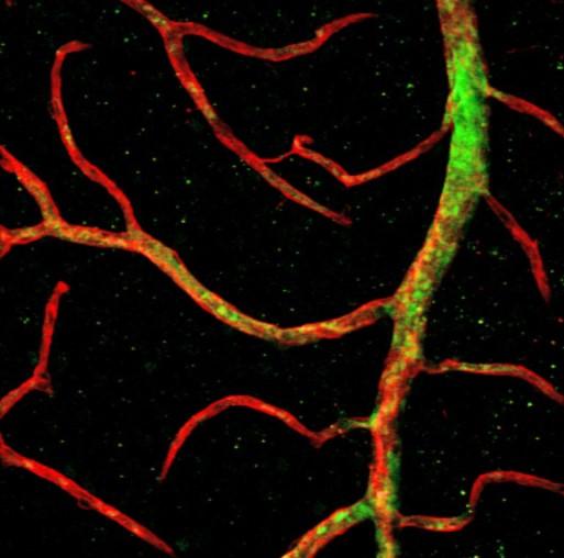 Human Vascular Progenitor Cells