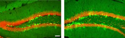 Newborn Neurons in Mouse Hippocampus
