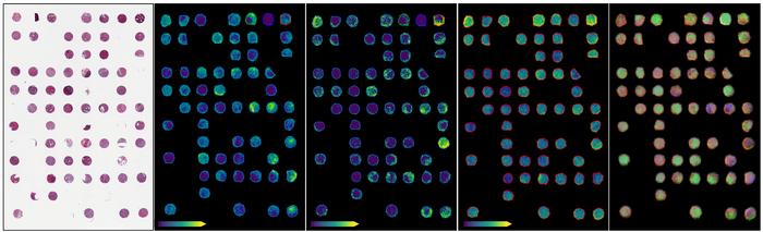 Seeing inside tumours at the molecular level