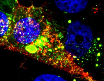 RSV Infected Cell
