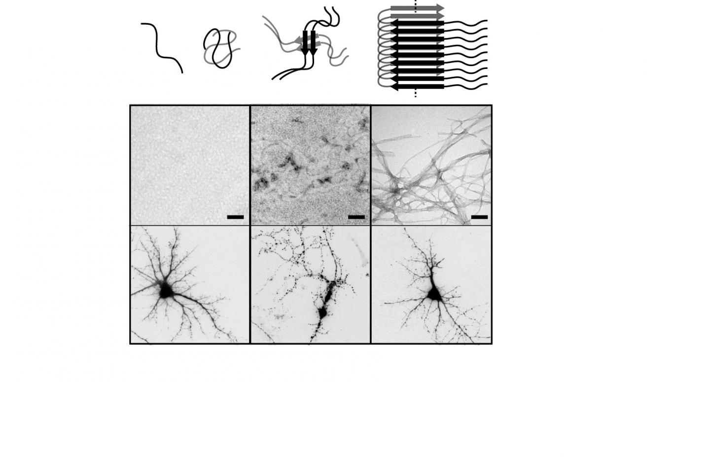 Representative Image of the Aggregation of Beta-Amyolid