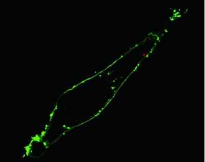 HeLa Cell and Endoscopic Illumination