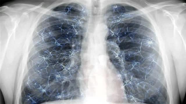 SpiroCall Video
