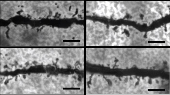 Microscopy images showing dendrites and dendritic spines