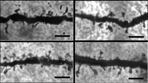 Microscopy images showing dendrites and dendritic spines