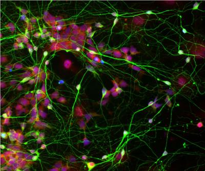 Human Neural Stem Cells