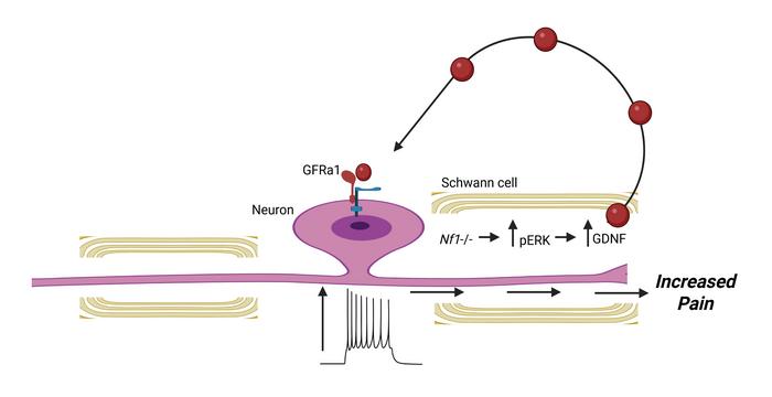 How NF1 can trigger pain even before tumors form