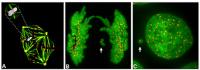 Chromosome Encased in a Micronucleus