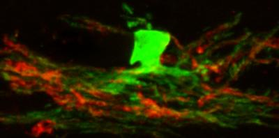 Oligodendrocytes