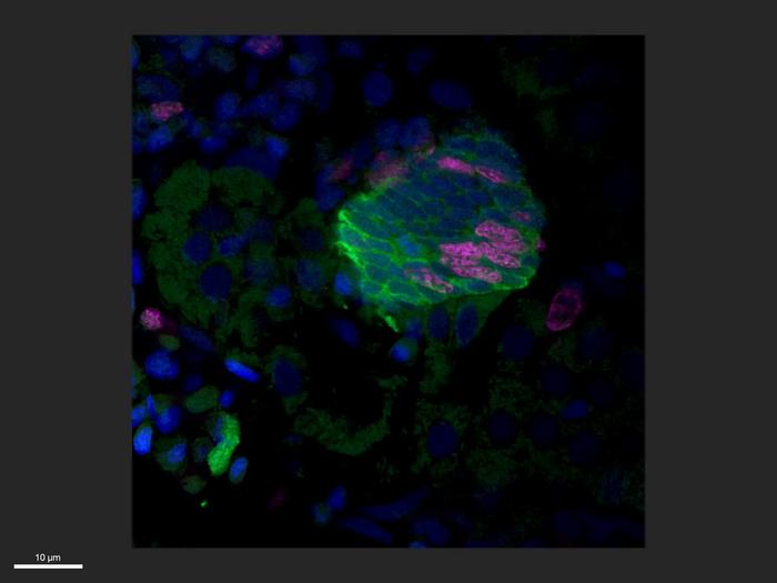 A zebrafish’s regenerating kidney