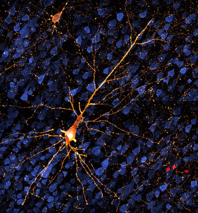 Exploring Early Stage Alzheimer’s Disease
