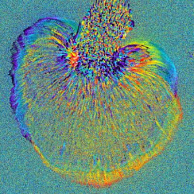Dendritic Cell