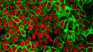 Human colon cancer cells