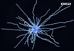 BGI Genomics Study Uncovers Brain Damage Progression in Alzheimer's Disease