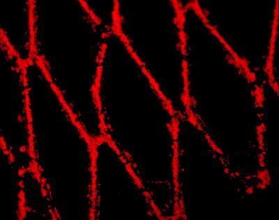 Magnetic Nanoparticles