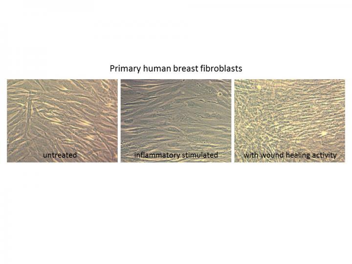 Fibroblasts