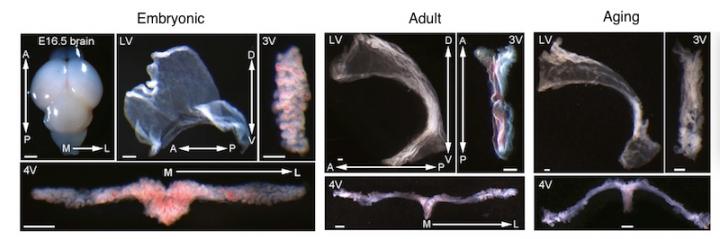 Extracting choroid plexus tissue