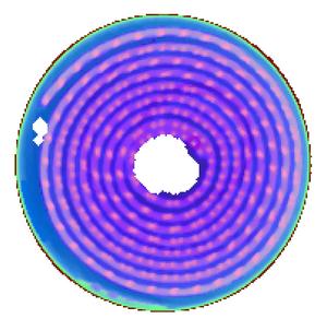 CHXI-MMT Image