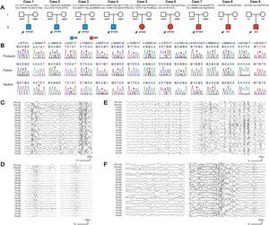 Genetic data and representative EEGs of cases with CSMD1 variants.