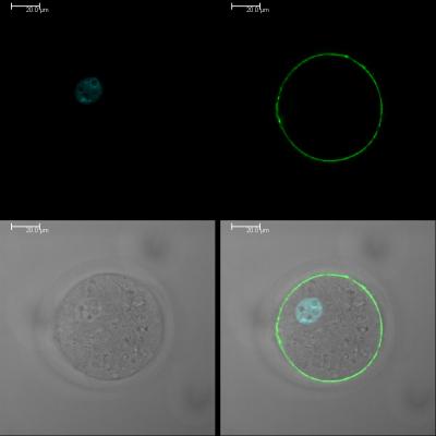 In ICSI File the Green Is Juno, Blue the Pronuclei