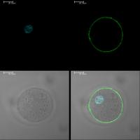 In ICSI File the Green Is Juno, Blue the Pronuclei