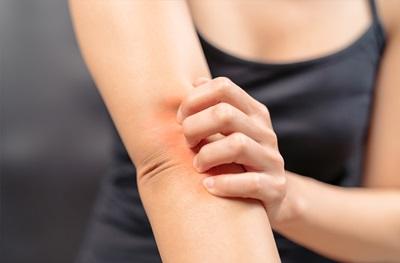 Skin Health
