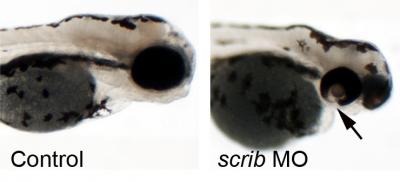 Katsanis Coloboma Zebrafish