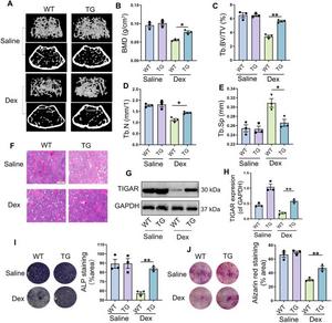 Protective role of TIGAR on dexamethasone (Dex)-induced bone loss.