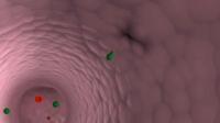 Spying on Cancer Cell Invasion