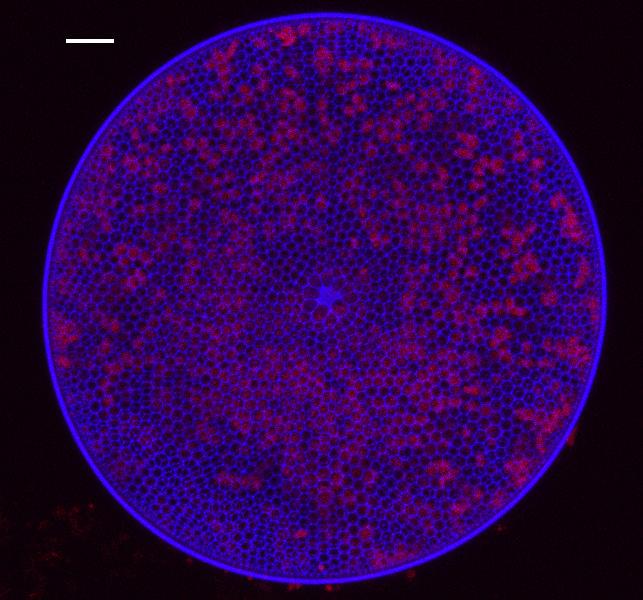 Diatom Cell