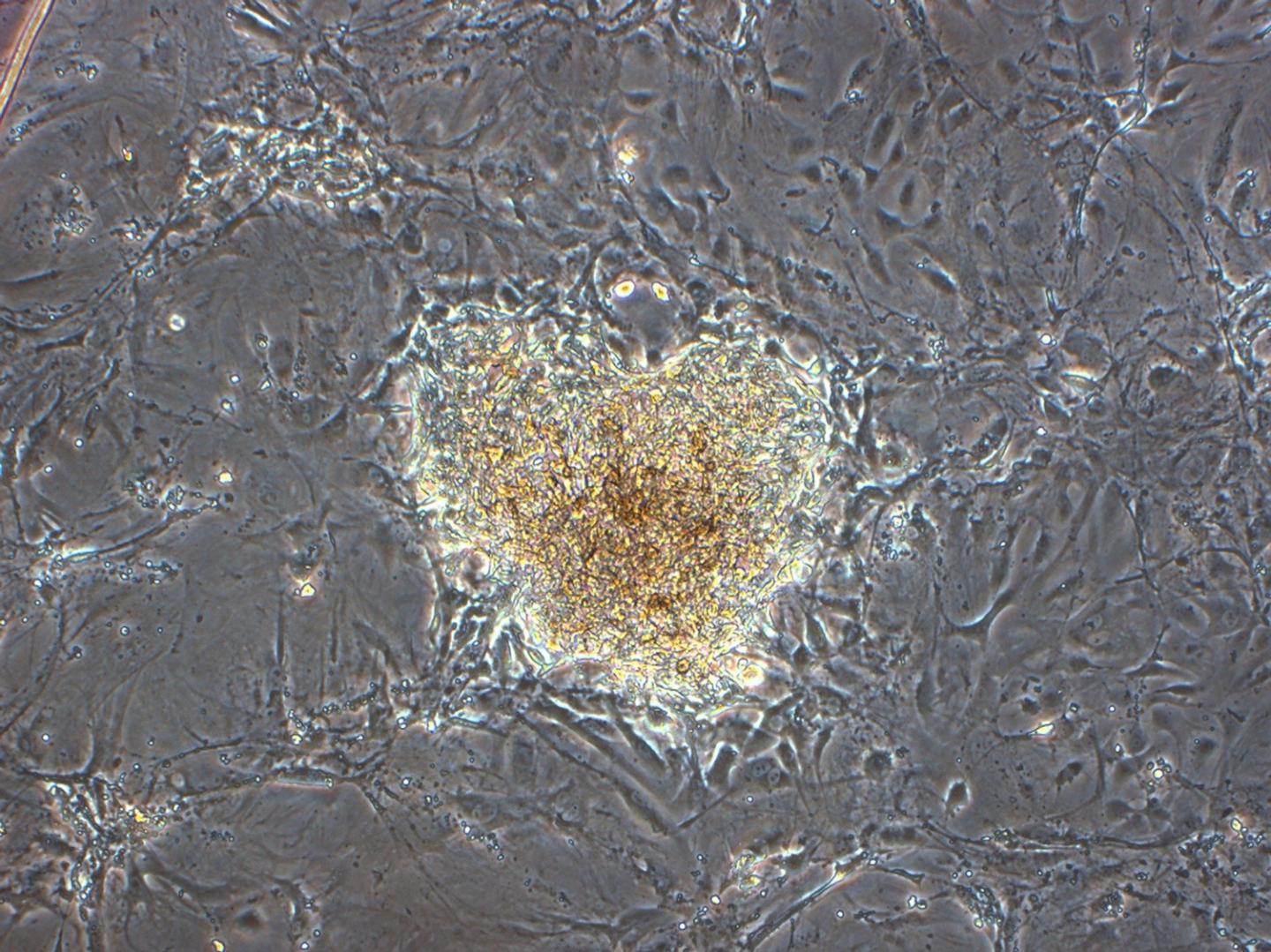 Tasmanian Devil Stem Cell Colony